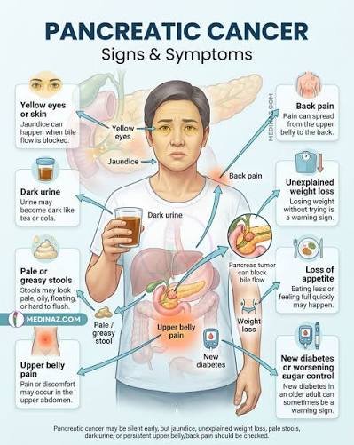 Pancreatic Cancer